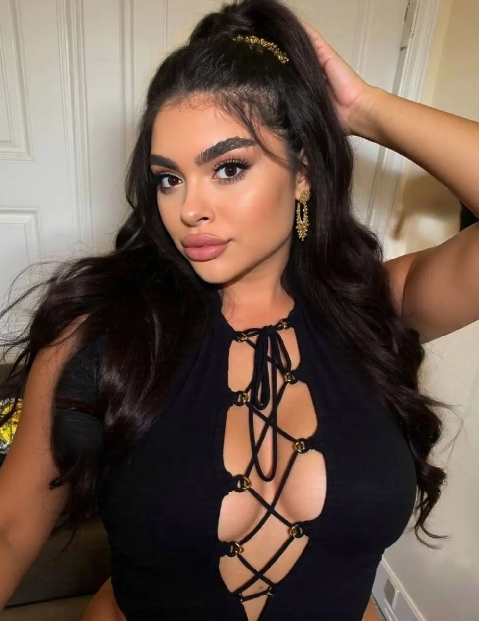 Esmi